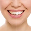 بهترین خمیردندان سفید کننده را می شناسید؟